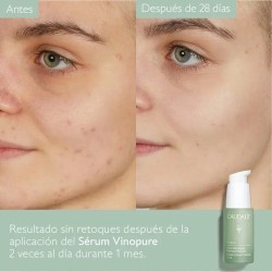 Caudalie Vinopure Sérum Salicílico 30 ml + Stop Granos Salicílico 15 ml