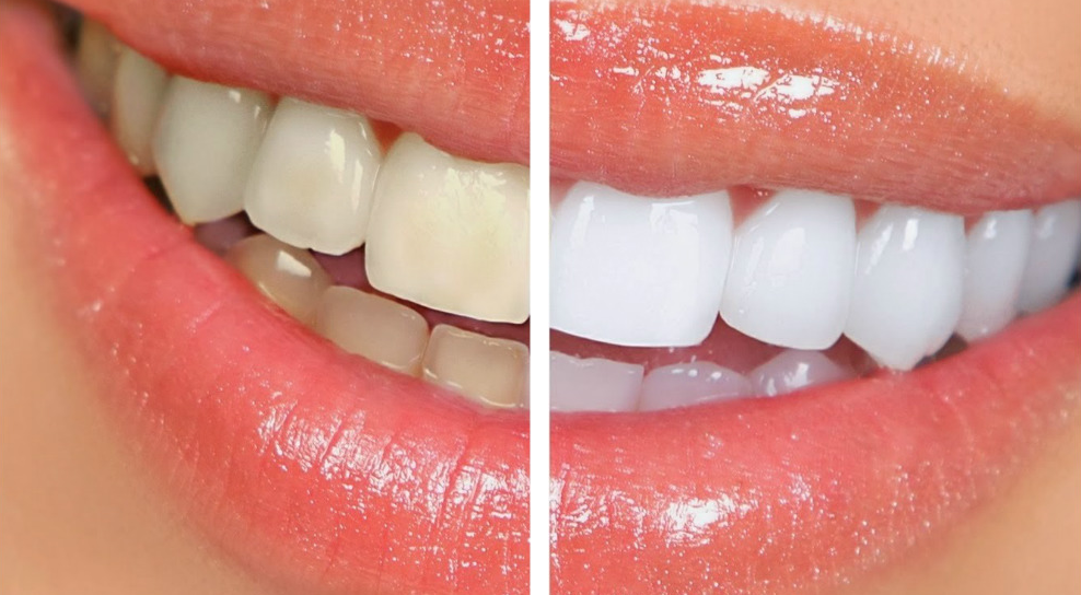 Cuidate la dentadura con recambios oral b - FarmaciaMarket Blog